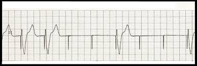 Failure To Capture Zander Perioperative Education Failure To Capture Zander Perioperative Education